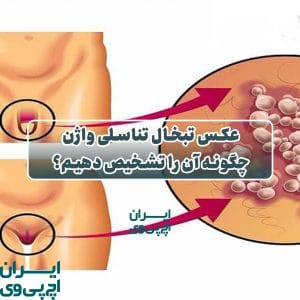 عکس تبخال تناسلی واژن