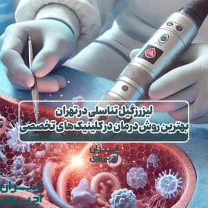 لیزر زگیل تناسلی در تهران