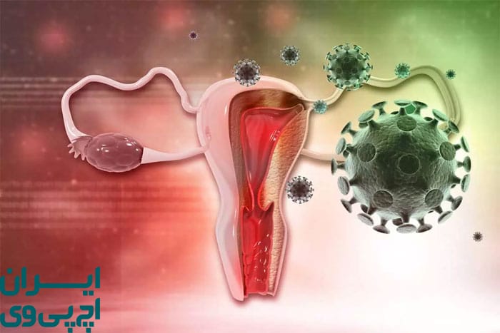 آیا درمان قطعی برای ویروس HPV وجود دارد؟