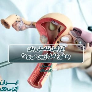 آیا زگیل تناسلی زنان به طور کامل از بین می‌رود؟