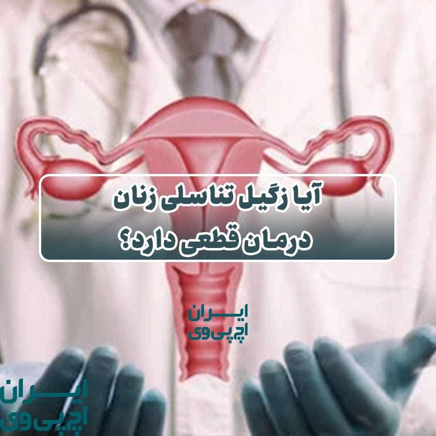 آیا زگیل تناسلی زنان درمان قطعی دارد؟