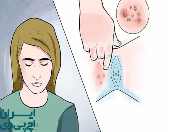 اگر HPV را درمان نکنم چه می‌شود؟