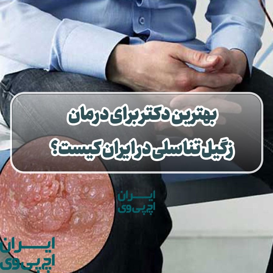بهترین دکتر برای درمان زگیل تناسلی در ایران کیست؟