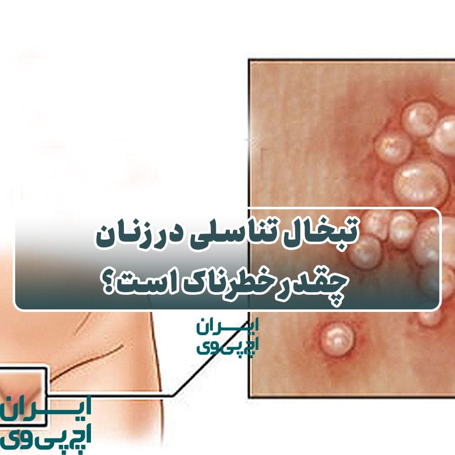 تبخال تناسلی در زنان چقدر خطرناک است؟