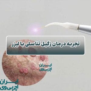 تجربه درمان زگیل تناسلی با لیزر