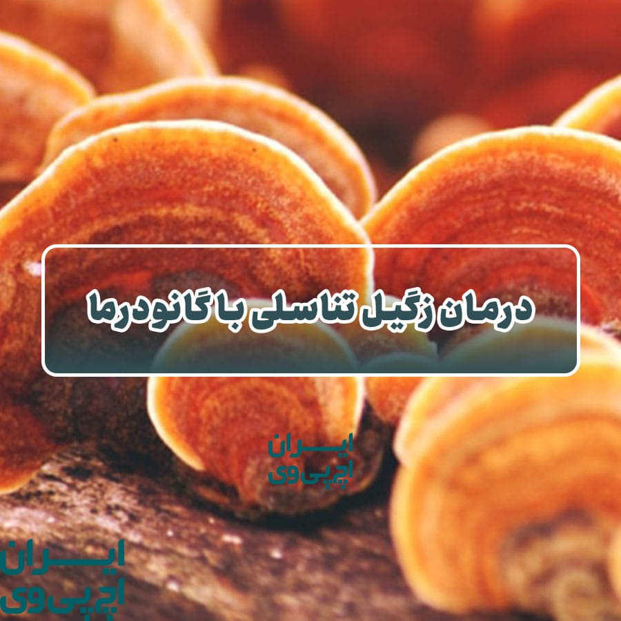 درمان زگیل تناسلی با گانودرما