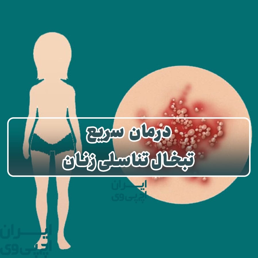 درمان سریع تبخال تناسلی زنان