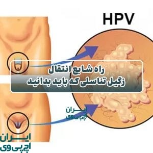راه شایع انتقال زگیل تناسلی که باید بدانید