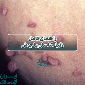 راهنمای کامل زگیل تناسلی یا جوش