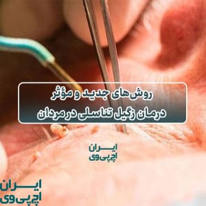 روش‌های جدید و مؤثر درمان زگیل تناسلی در مردان