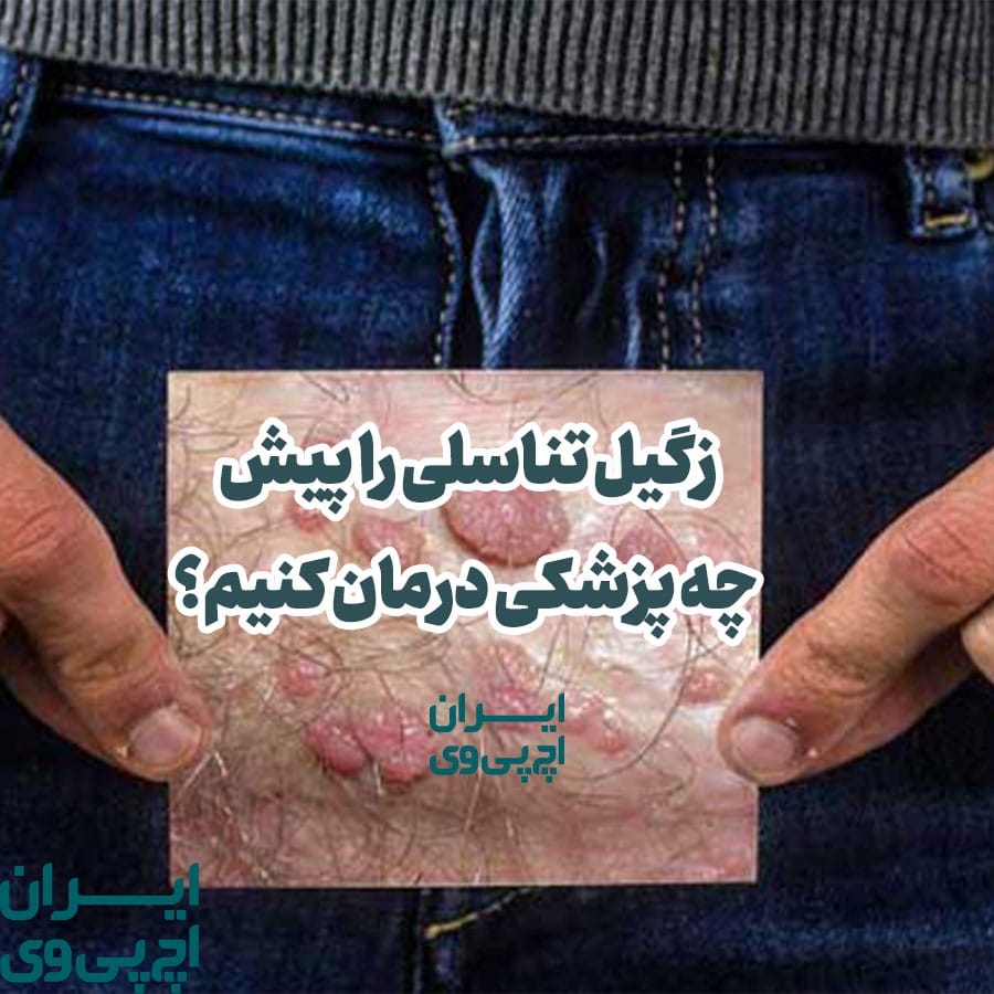 زگیل تناسلی را پیش چه پزشکی درمان کنیم؟