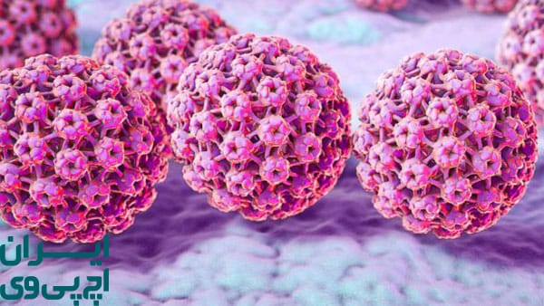 زگیل تناسلی چیست و چرا برگشت‌پذیر است؟