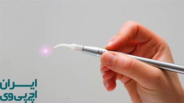 لیزر برای درمان HPV