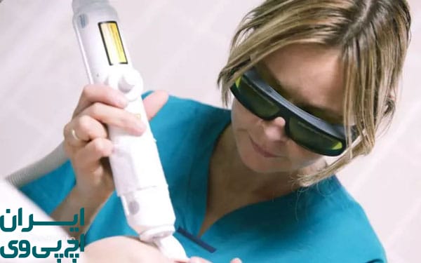 مزایای درمان زگیل تناسلی با لیزر