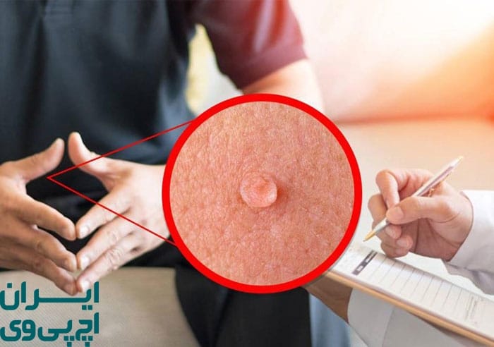 نحوه مصرف اصولی پودوفیلین