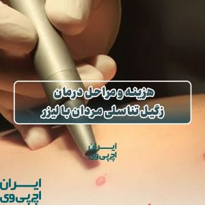 هزینه و مراحل درمان زگیل تناسلی مردان با لیزر