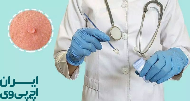 همکاری بین متخصص‌ها در درمان زگیل تناسلی