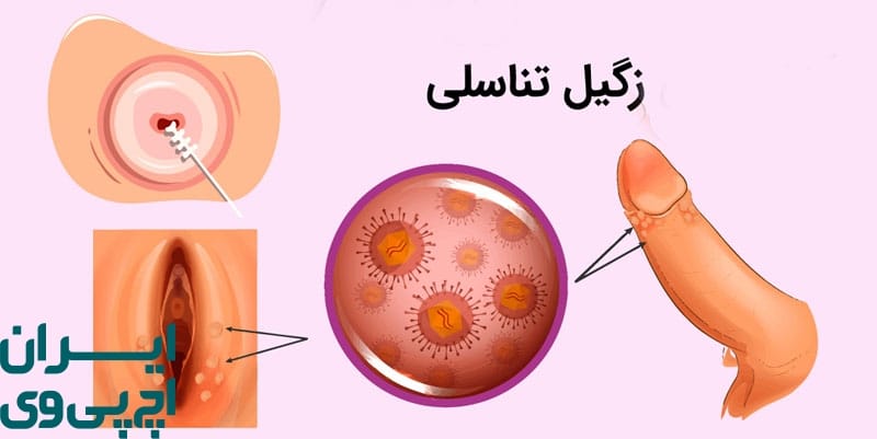 چرا تشخیص زودهنگام زگیل مهم است؟