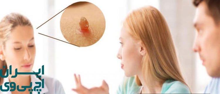 چه زمانی برای تشخیص زگیل تناسلی به پزشک مراجعه کنیم؟