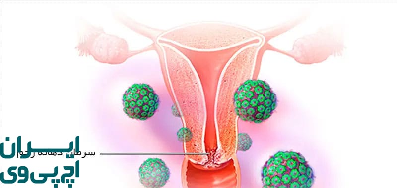 چه مدت طول می‌کشد تا HPV از بدن خارج شود؟
