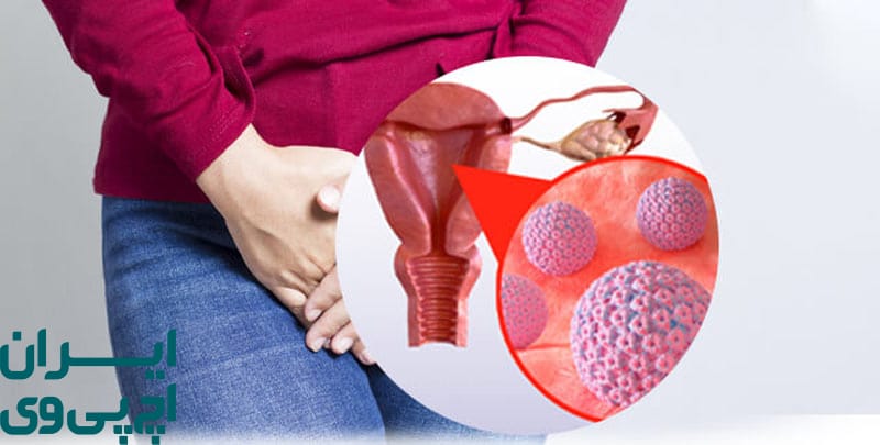 HPV فقط در افراد دارای روابط جنسی پرخطر دیده می‌شود