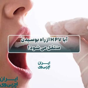آیا HPV از راه بوسیدن منتقل می‌شود؟