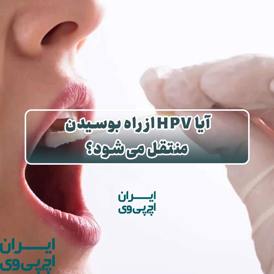 آیا HPV از راه بوسیدن منتقل می‌شود؟