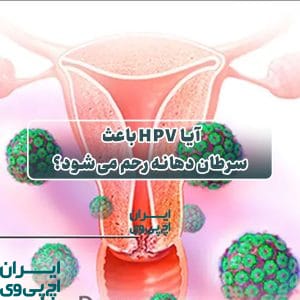 آیا HPV باعث سرطان دهانه رحم می‌شود؟