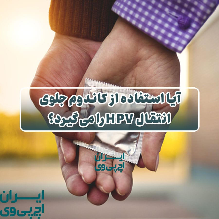 آیا استفاده از کاندوم جلوی انتقال HPV را می‌گیرد؟