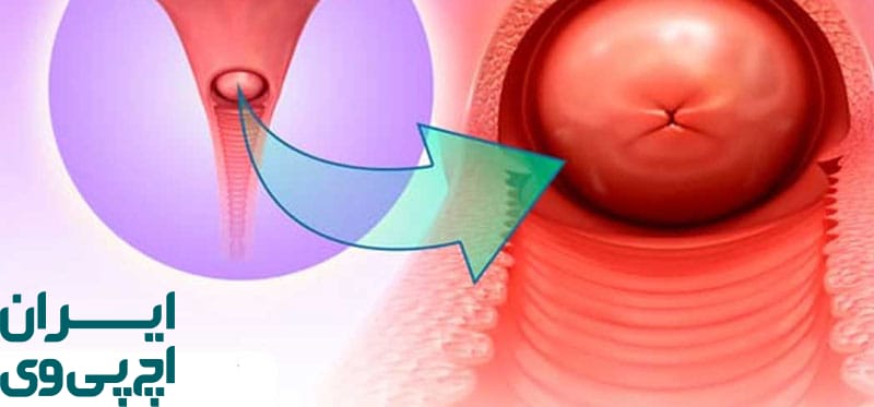 اهمیت پایش منظم وضعیت دهانه رحم در بارداری