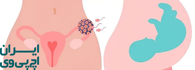 بررسی داروهای موضعی ضد HPV در دوران بارداری