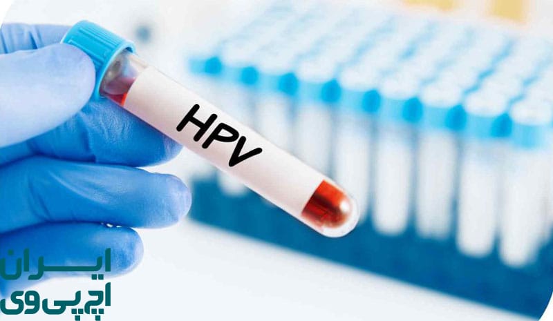 بررسی عملکرد آزمایش خون در تشخیص HPV