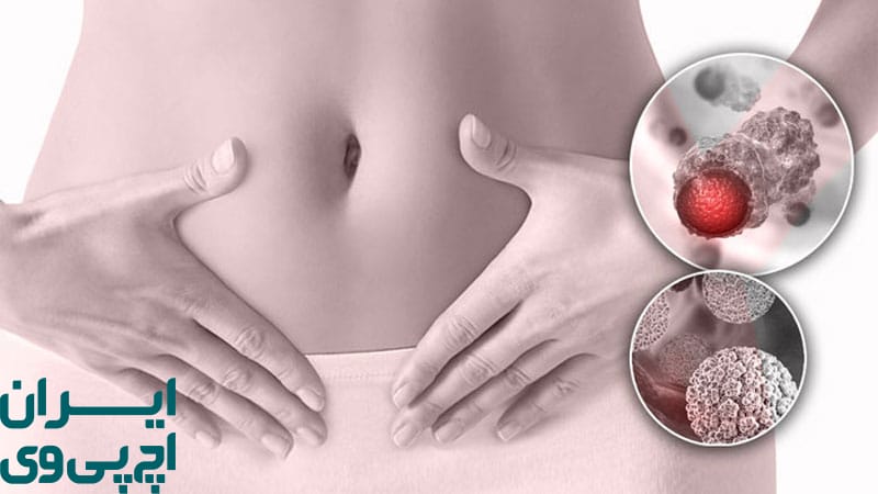 بررسی محل بروز زگیل