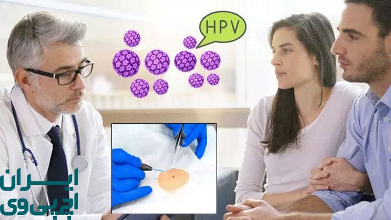 بعد از درمان زگیل HPV بهداشت ناحیه تناسلی باید چگونه ادامه یابد؟