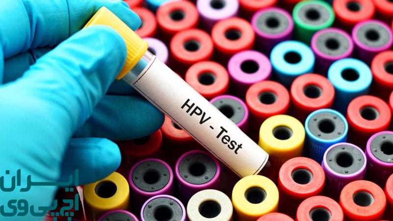 بهترین زمان برای انجام تست HPV