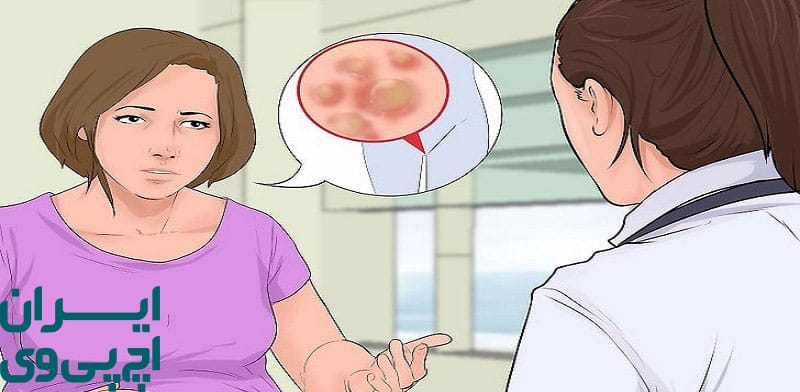 تأثیر نوع درمان HPV در بازگشت به رابطه جنسی