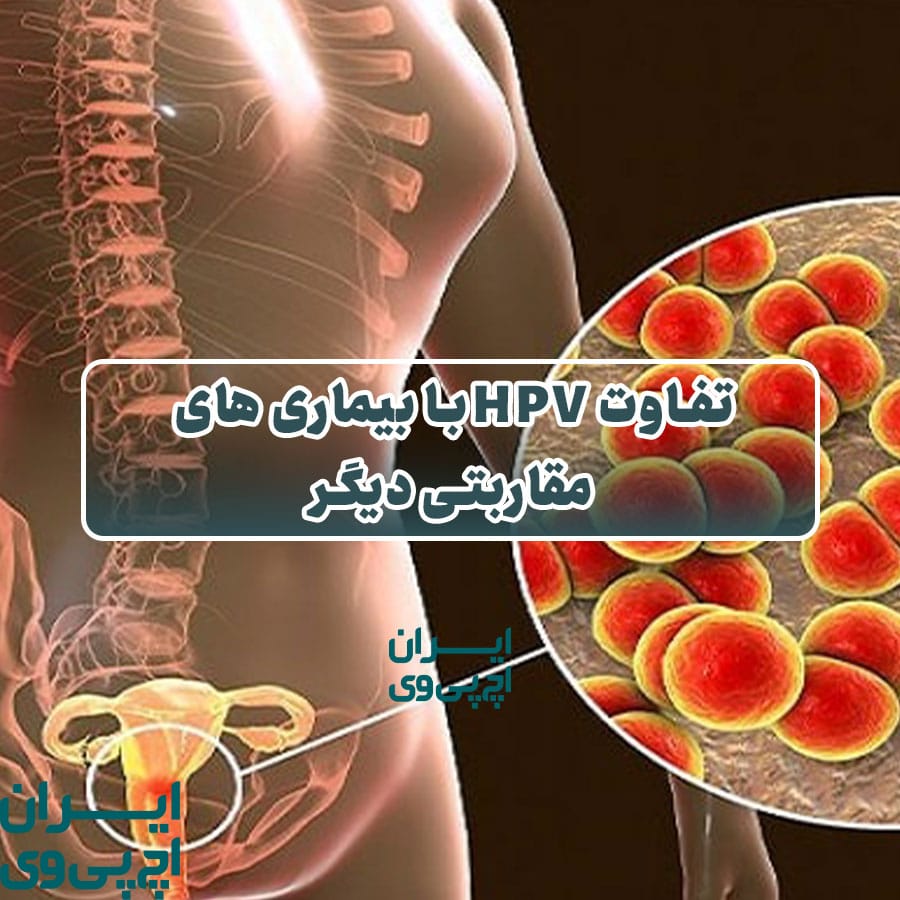 تفاوت HPV با بیماری‌ های مقاربتی دیگر