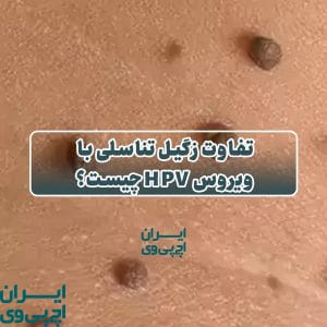 تفاوت زگیل تناسلی با ویروس HPV چیست؟