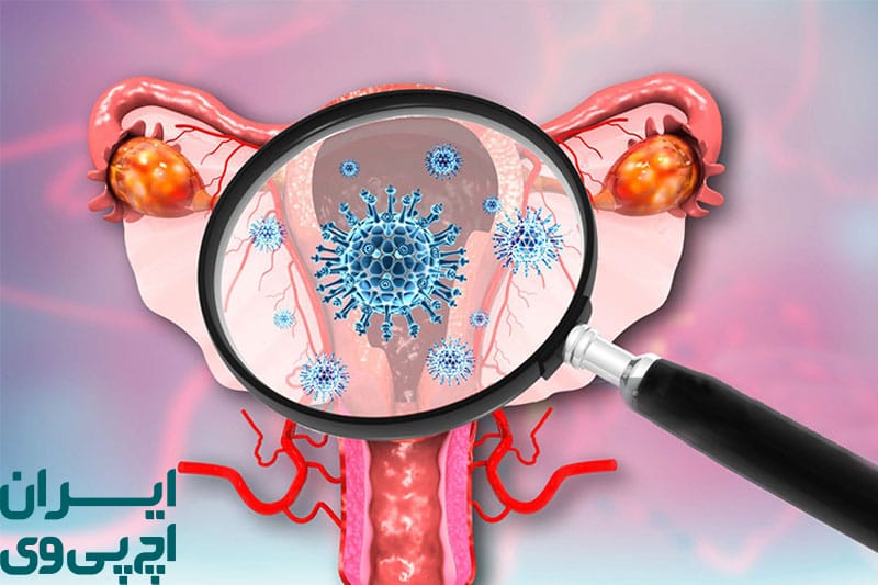 خطر سرطان‌ زایی ویژگی منحصر به‌ فرد HPV