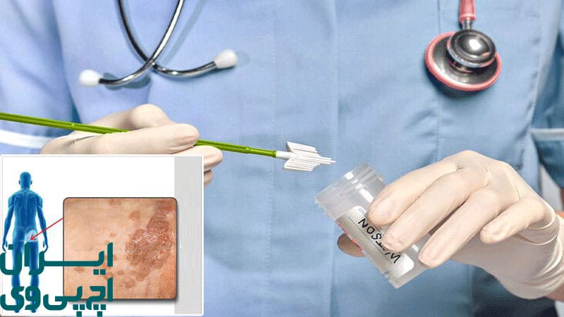 روابط جنسی ایمن و مدیریت خطر بازگشت بیماری HPV