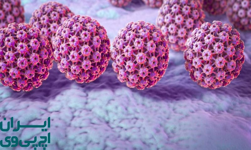 روش‌های فیزیکی حذف زگیل مانند کرایوتراپی و لیزر