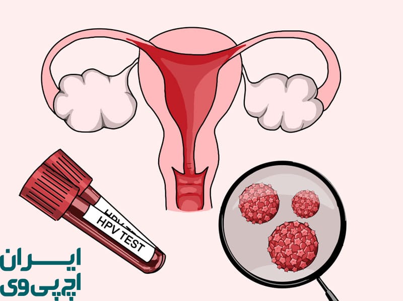 روند تشخیص HPV نوع ۱۶ و ۱۸