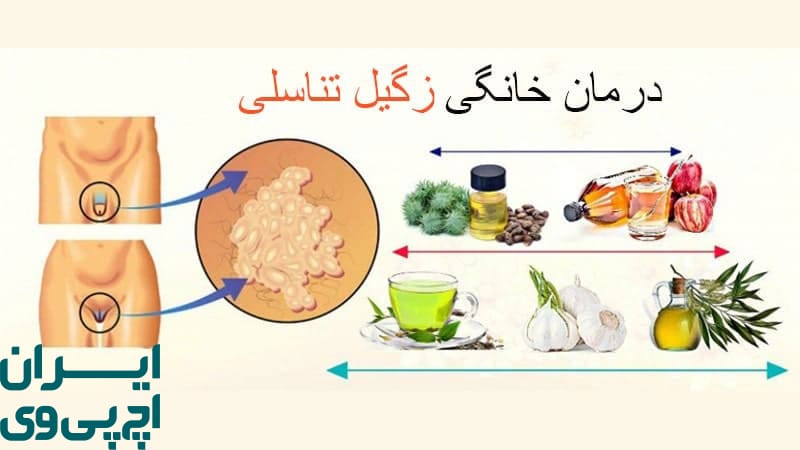 سیر بیک آنتی‌ ویروس طبیعی برای کنترل زگیل‌ های پوستی