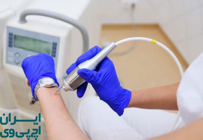 شرایط ایده‌آل برای موفقیت درمان فریز HPV 