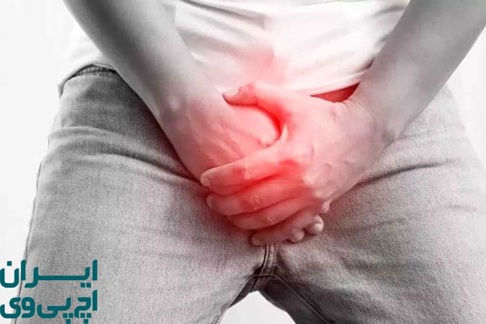 علائم HPV در مردان