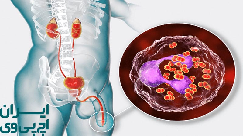 ماهیت ویروسی یا باکتریایی بیماری‌ های مقاربتی