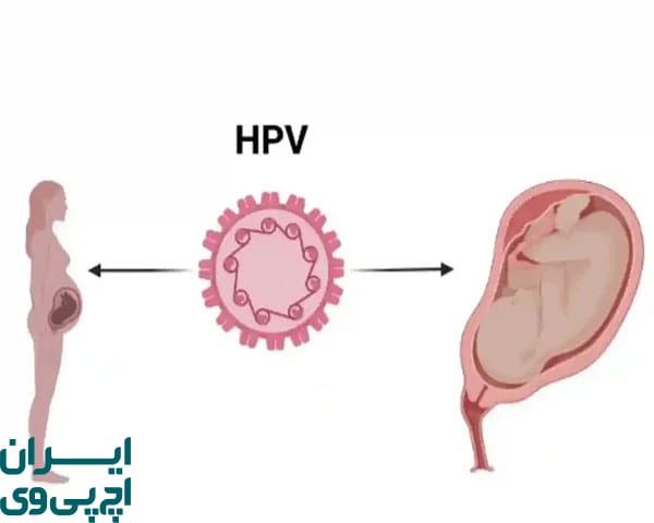 مسیرهای اصلی انتقال HPV