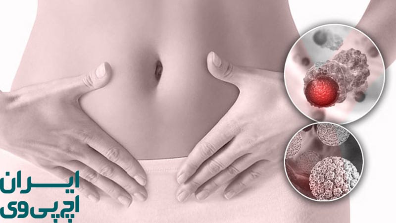 واکسن HPV باعث ناباروری می‌شود