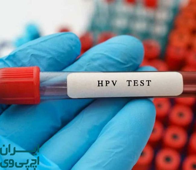 پرهیز از دست‌ کاری ضایعات برای جلوگیری از گسترش HPV