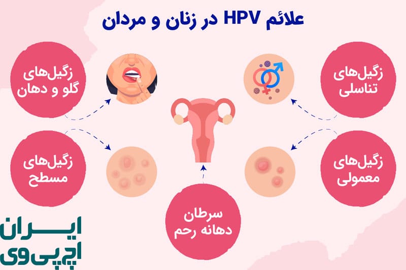 انواع مختلف HPV و تفاوت در بروز علائم